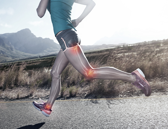 Osteoarthritus-Image